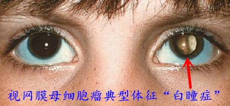 df47fbd825d54554b0af45beb06ec0d3.jpg